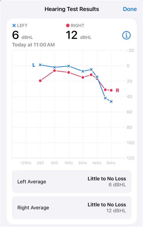 Apple Hearing Test Release Date: What to Expect in 2024