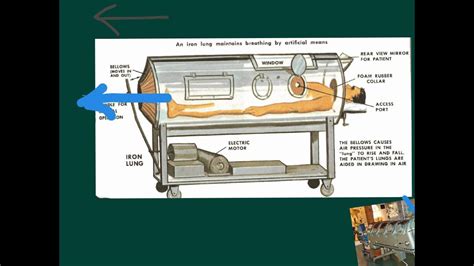 Iron Lung Diagram