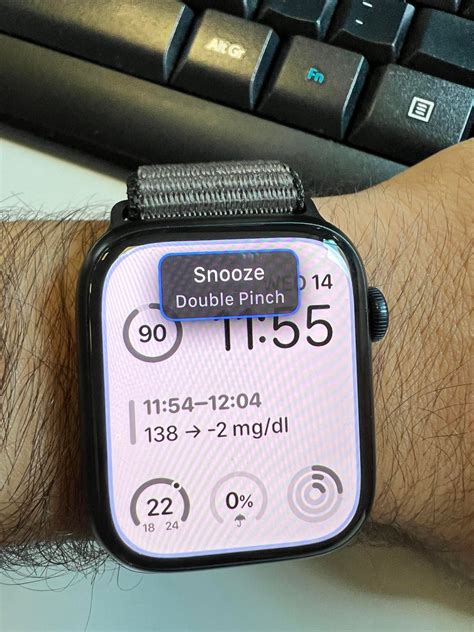 Since The New Update I Get This Message Every Time I Look At My Watch Can This Be Removed R Applewatch